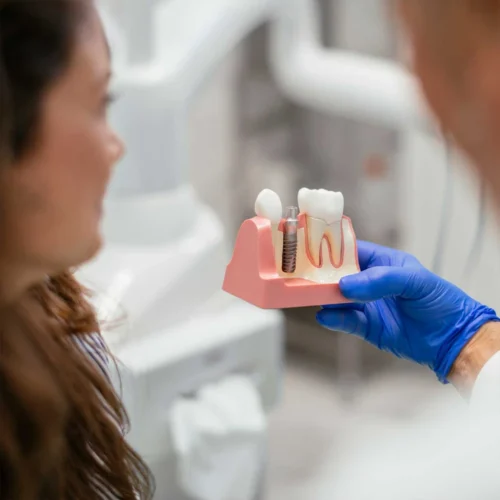 Implantes Dentales en Madrid (Chamberi)